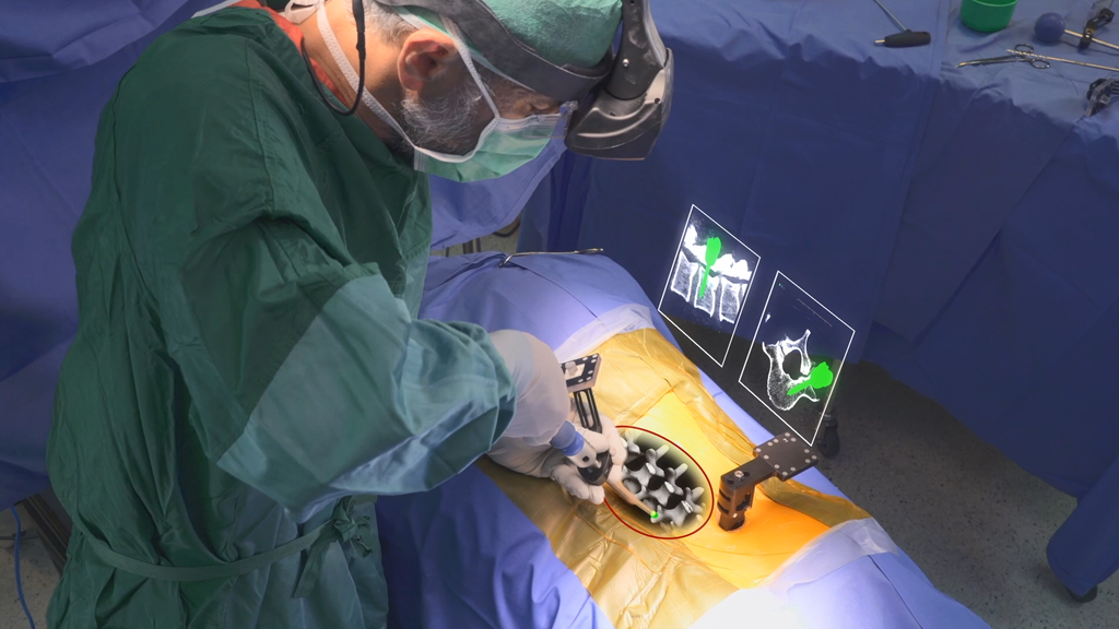 Israeli Augmented Reality Surgical Navigation System Undergoes Successful Clinical Trials