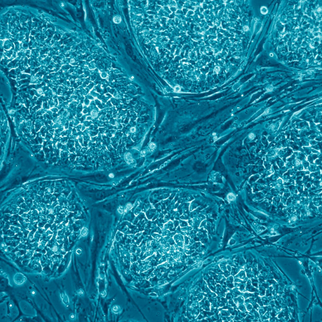 Hebrew University maps breakthrough atlas of the human genome and identifies 180,000 cell mutations